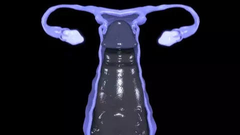 Blade x Alilkira 3rd Full [Fan Edit/Extended] | Kx2-SFM