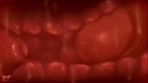 Pussy X-Ray (No Moaning, Flesh Sounds)